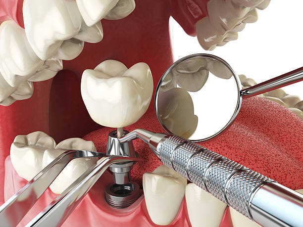 Reliable IL Emergency Dentist Solutions